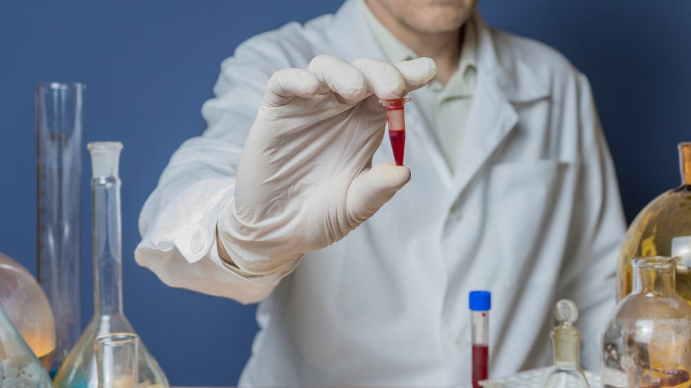 Blood test can now predict whether you’ll die — in next 10 years!