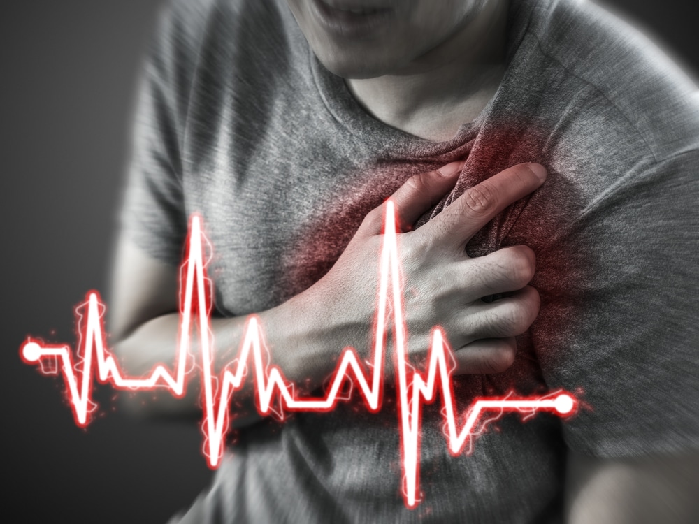 Worlds First Ai Can Predict When Patients Will Have A Heart Attack Or