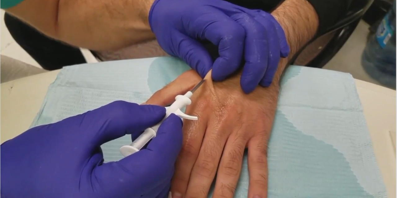 Would you consider having an implant in your hand?