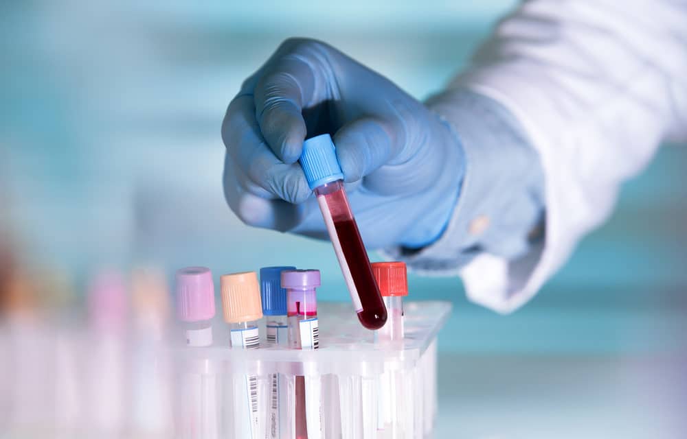 For the first time, Blood test detects cancer before symptoms