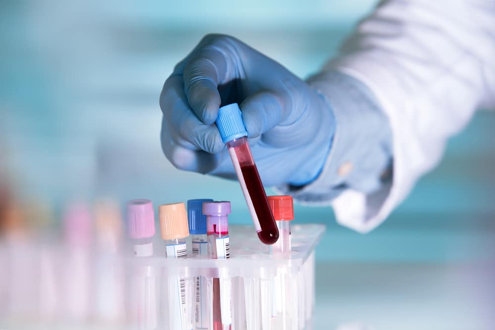 blood-test-detects-50-types-of-cancer-pancreatic-cancer-awareness-pca