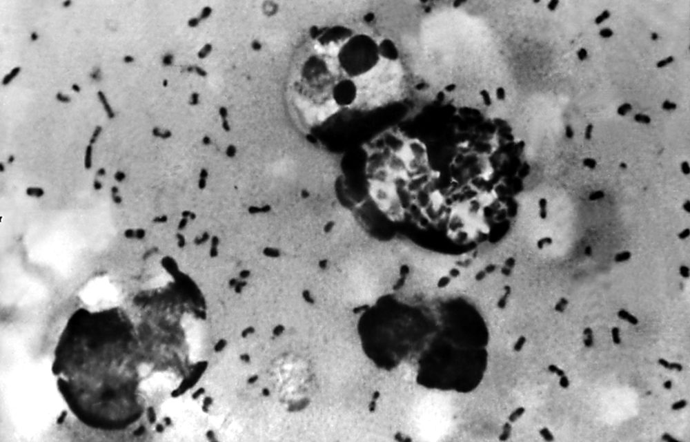 China Quarantines Region While Second Case Of Bubonic Plague Diagnosed in New Mexico.