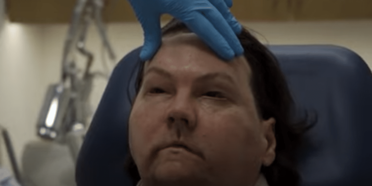 Man receives new face and hands in extraordinary rare surgery