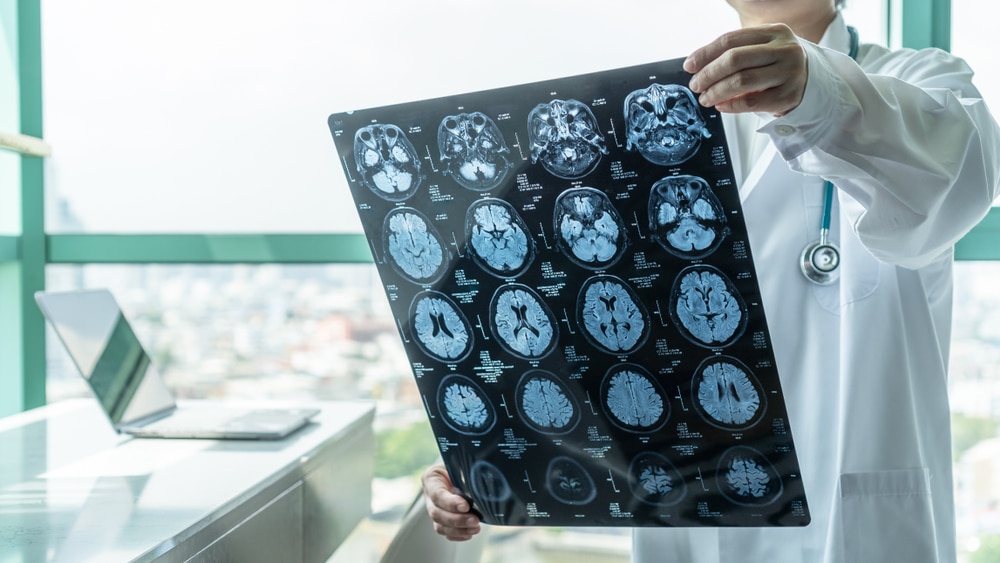 Mystery brain disease leaves doctors baffled