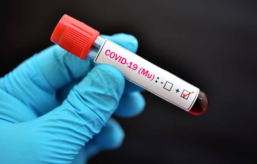 Move over Delta, New ‘MU’ COVID variant has now been found in 49 U.S. states