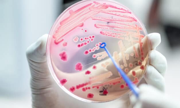 Antimicrobial resistance is now a leading cause of death worldwide