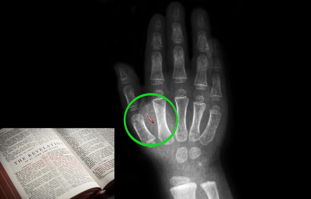 (NEW PODCAST) $300 microchip implants for the hand, Are we truly in the “End Times”?