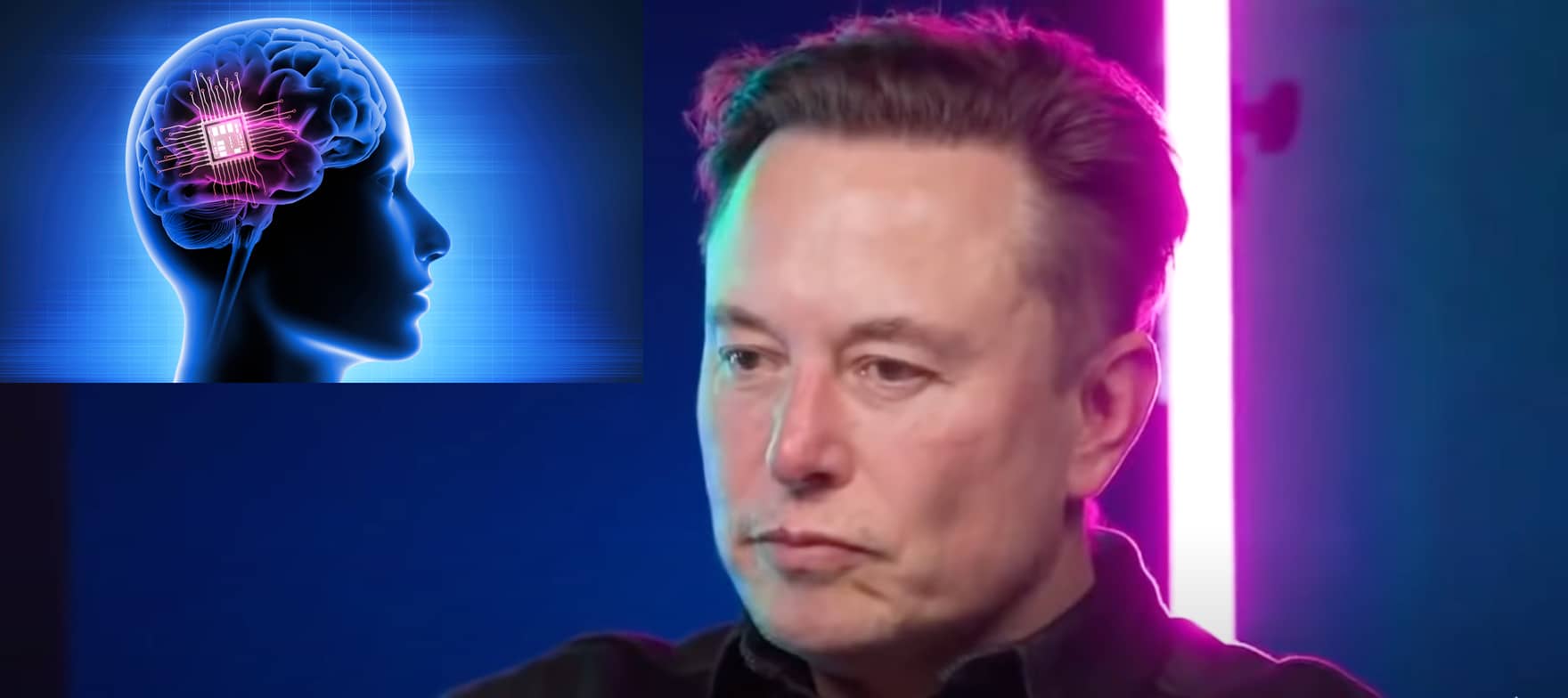 Elon Musk says his Neuralink brain chips ‘will 100 cure’ common