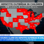 UPDATE: Another child has died in the US from mysterious hepatitis cases with unknown cause