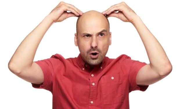 Judge rules that calling men ‘bald’ can be classed as “sexual harassment”