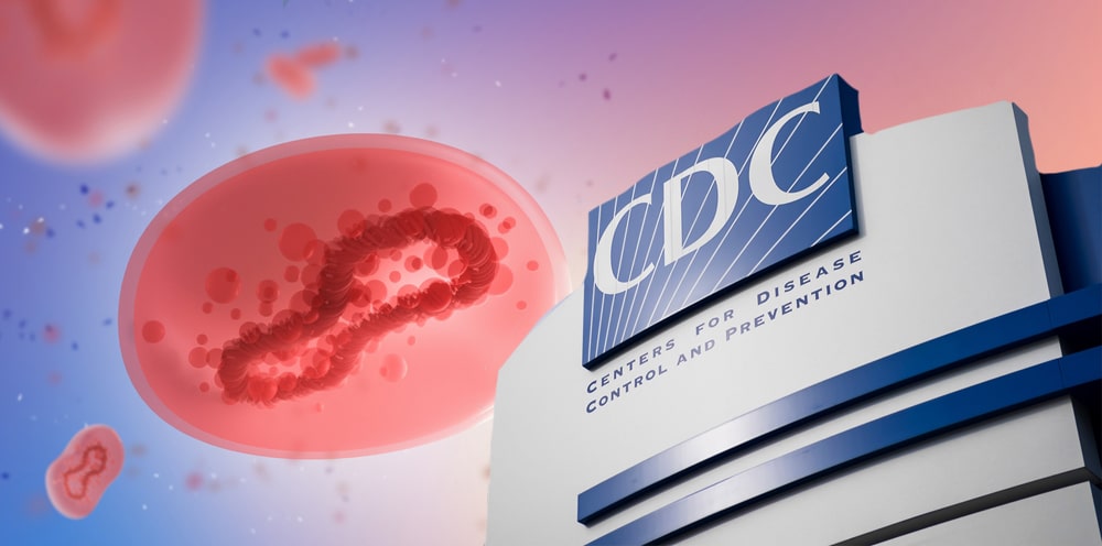 CDC warns that “Some Community Transmission” Of Monkeypox may be happening in the U.S.
