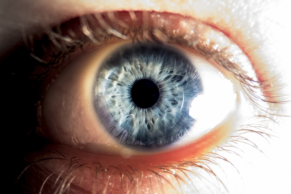 Scientists ‘reverse Death By Bringing Dead Eyes Back To Life In