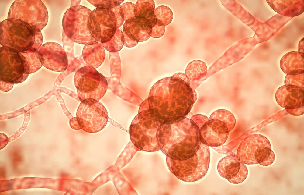 Michigan health officials report first case of a rare and potentially deadly fungus in an older adult