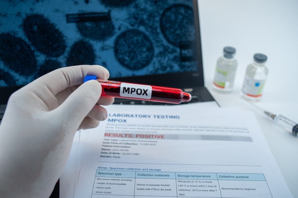 Cluster of Mpox cases in Chicago raises concerns of resurgence this summer