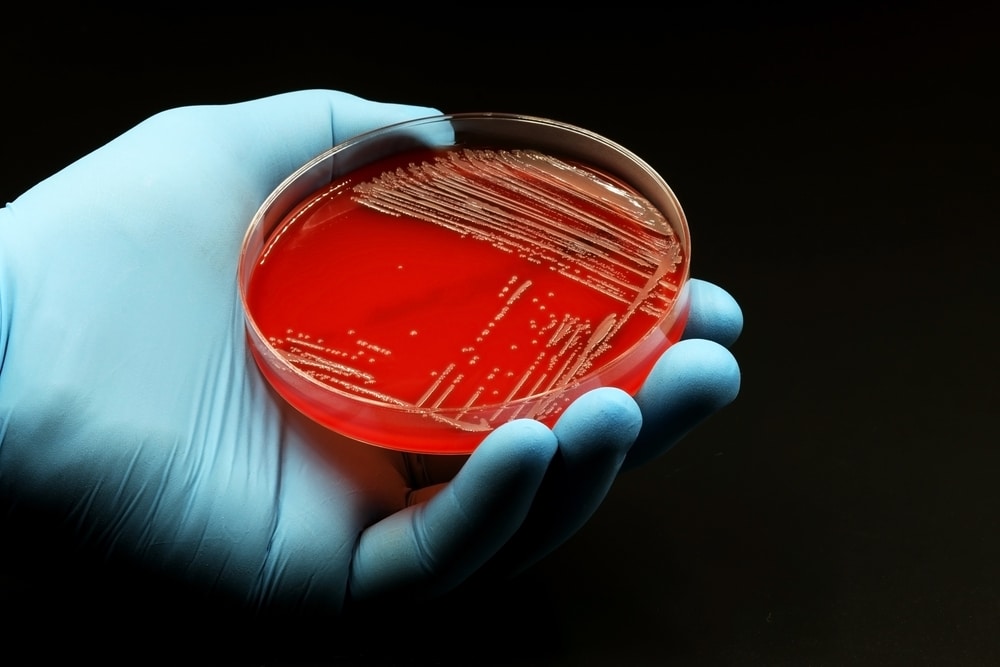 Fungus ‘superbug’ cases have risen to the highest levels in Nevada