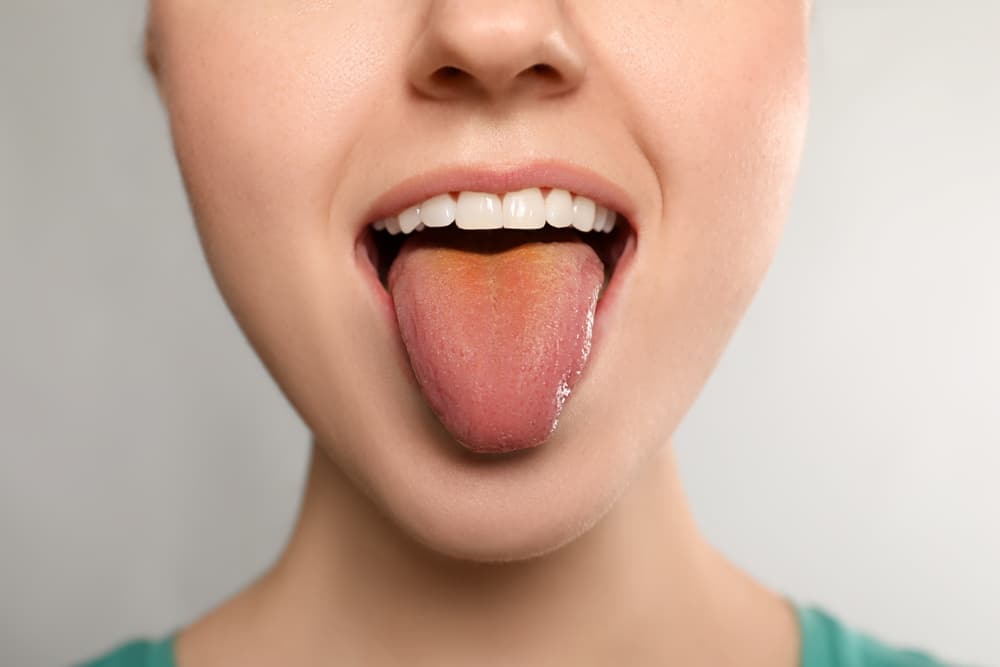 AI model 98% accurate in detecting diseases by looking at your tongue